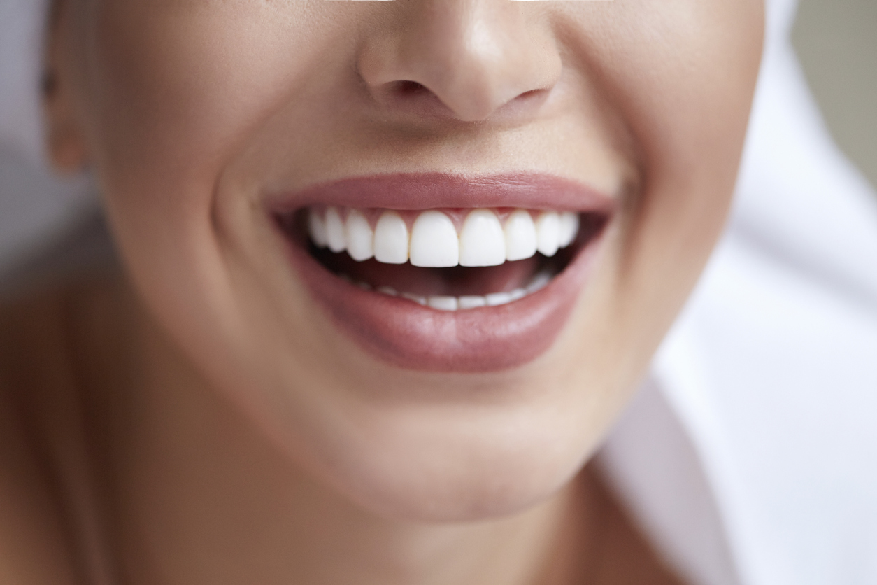Cosmetic dentistry
